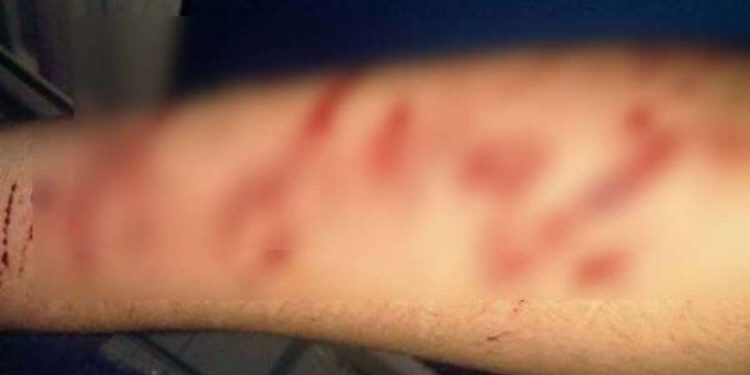 आत्महत्या: यहां बीमारी से तंग आकर नौजवान ने ऐसे की जीवन लीला समाप्त।