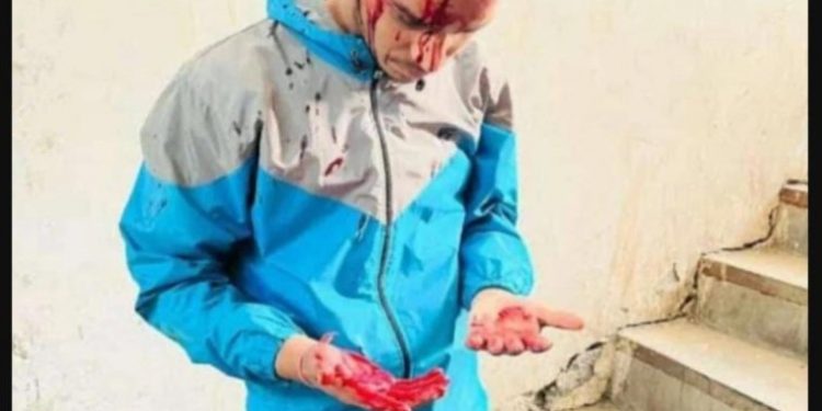 देहरादून:- युवाओं पर हुई लाठीचार्ज और बर्बरता