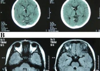 छुट्टी पर रहते हुए एक ही आदमी की बना दी तीन रिपोर्ट, सिटी स्कैन भी फर्जी करता था देखिए कैसे दबोचा पुलिस ने।