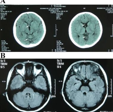 छुट्टी पर रहते हुए एक ही आदमी की बना दी तीन रिपोर्ट, सिटी स्कैन भी फर्जी करता था देखिए कैसे दबोचा पुलिस ने।
