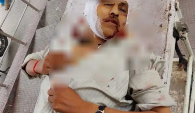 दुखद घटना: यहां पिता की सड़क हादसे में पिता की दर्दनाक मौत। बेटी की हालत गंभीर..