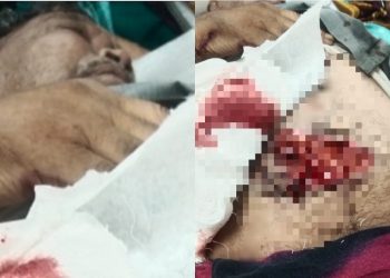 बड़ी खबर: यहां बुजुर्ग पर सांड ने किया हमला, गंभीर हालत, दिल दहला देने वाली तस्वीर..