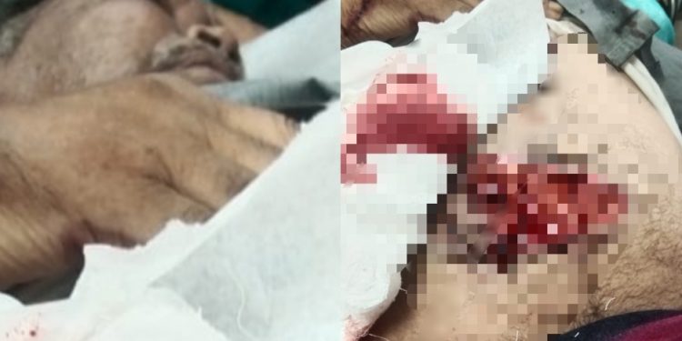 बड़ी खबर: यहां बुजुर्ग पर सांड ने किया हमला, गंभीर हालत, दिल दहला देने वाली तस्वीर..