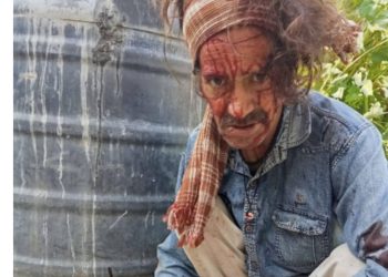 ढंगसयोली गाँव में गुलदार का जानलेवा हमला — जनता में गहरा आक्रोश, प्रशासन से तुरंत मुआवजा व सुरक्षा की मांग