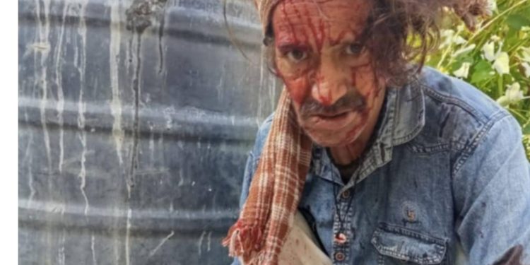 ढंगसयोली गाँव में गुलदार का जानलेवा हमला — जनता में गहरा आक्रोश, प्रशासन से तुरंत मुआवजा व सुरक्षा की मांग