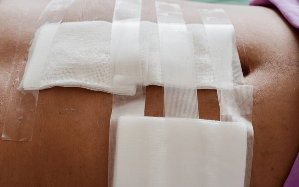 सिजेरियन डिलीवरी के बाद महिला की दर्दनाक मौत, पेट में छूटी कॉटन पट्टी से फैला संक्रमण