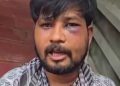 देहरादून में युवक के साथ क्रूरता,  बंधक बनाकर बेहरमी से पीटा, करेंट दिया, लोहे ही गर्म रोड से दगा