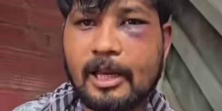 देहरादून में युवक के साथ क्रूरता, बंधक बनाकर बेहरमी से पीटा, करेंट दिया, लोहे ही गर्म रोड से दगा